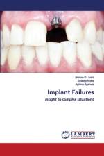Implant Failures af Akshay D Joshi