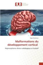 Malformations du developpement cortical af Hager Barakizou