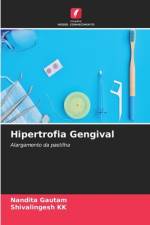 Hipertrofia Gengival af Shivalingesh Kk