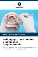 Heilungsprozess bei der Diodenlaser-Gingivektomie af Rada Torezova Kazakova