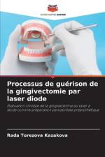 Processus de guerison de la gingivectomie par laser diode af Rada Torezova Kazakova