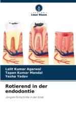 Rotierend in der endodontie af Tapan Kumar Mandal