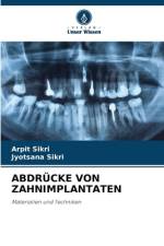 ABDRÜCKE VON ZAHNIMPLANTATEN af Arpit Sikri