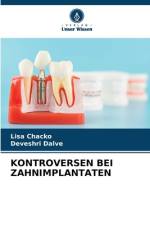 KONTROVERSEN BEI ZAHNIMPLANTATEN af Lisa Chacko