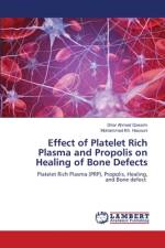 Effect of Platelet Rich Plasma and Propolis on Healing of Bone Defects af Dirar Ahmed Qassim