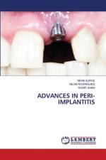 ADVANCES IN PERI-IMPLANTITIS af Neha Surve