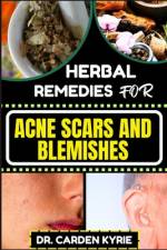 Herbal Remedies for Acne Scars and Blemishes af Carden Kyrie