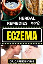 Herbal Remedies for Eczema af Carden Kyrie