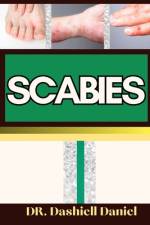 Scabies af Dashiell Daniel