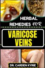Herbal Remedies for Varicose Veins af Carden Kyrie