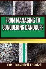From Managing to Conquering Dandruff af Dashiell Daniel