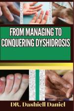 From Managing to Conquering Dyshidrosis af Dashiell Daniel