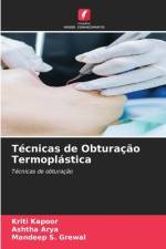 Técnicas de Obturação Termoplástica af Kriti Kapoor