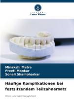 Häufige Komplikationen bei festsitzendem Teilzahnersatz af Minakshi Matre