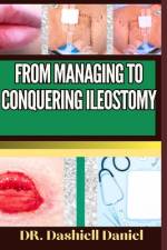 From Managing to Conquering Ileostomy af Dashiell Daniel