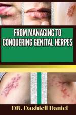 From Managing to Conquering Genital Herps af Dashiell Daniel