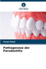 Pathogenese der Parodontitis af Faraz Patel