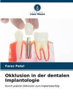Okklusion in der dentalen Implantologie af Faraz Patel