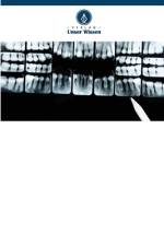 Wurzelresorption af Nimisha N. Mahajan