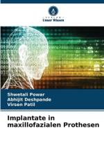 Implantate in maxillofazialen Prothesen af Shwetali Powar