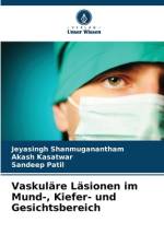 Vaskuläre Läsionen im Mund-, Kiefer- und Gesichtsbereich af Jeyasingh Shanmuganantham