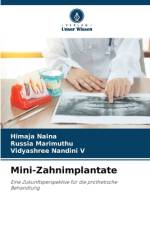 Mini-Zahnimplantate af Himaja Naina
