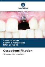 Osseodensifikation af Yashasri Nayak
