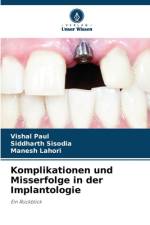 Komplikationen und Misserfolge in der Implantologie af Vishal Paul