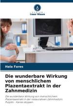 Die wunderbare Wirkung von menschlichem Plazentaextrakt in der Zahnmedizin af Hala Fares