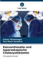 Konventionelle und laparoskopische Cholezystektomie af Jomari Montenegro