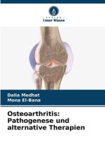 Osteoarthritis: Pathogenese und alternative Therapien af Dalia Medhat