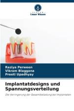 Implantatdesigns und Spannungsverteilung af Raziya Perween