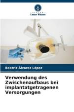 Verwendung des Zwischenaufbaus bei implantatgetragenen Versorgungen af Beatriz Álvarez López