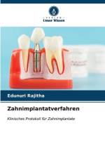 Zahnimplantatverfahren af Edunuri Rajitha