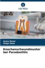 Knochenschwundmuster bei Parodontitis af Asma Desai