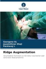 Ridge Augmentation af Georgeno Gl