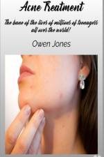 Acne Treatment
