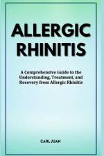A Comprehension of Allergic Rhinitis af Carl Juan