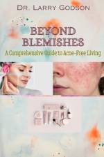 Beyond Blemishes af Larry Godson