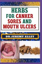 Herbs for Canker Sores and Mouth Ulcers af Jeremy Alley