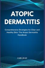 Atopic Dermatitis af Carl Juan