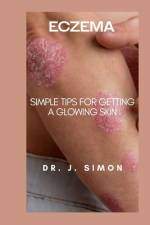 Eczema af J Simon