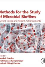 Methods for the Study of Microbial Biofilms af Abhishek Guldhe