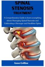 Spinal Stenosis Treatment af Anna Collins