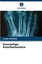 Knorpelige Knochentumore af Lynda Aoudia