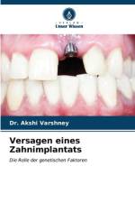 Versagen eines Zahnimplantats af Akshi Varshney
