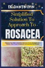 Simplified Solution Approach To ROSACEA af Quentin Glyn
