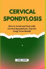 Cervical Spondylosis af Carl Juan