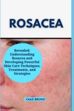 Rosacea af Chad Bruno