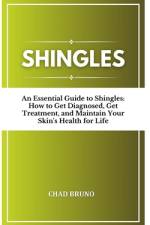Shingles af Chad Bruno